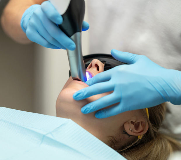 Lakewood Intraoral Photos